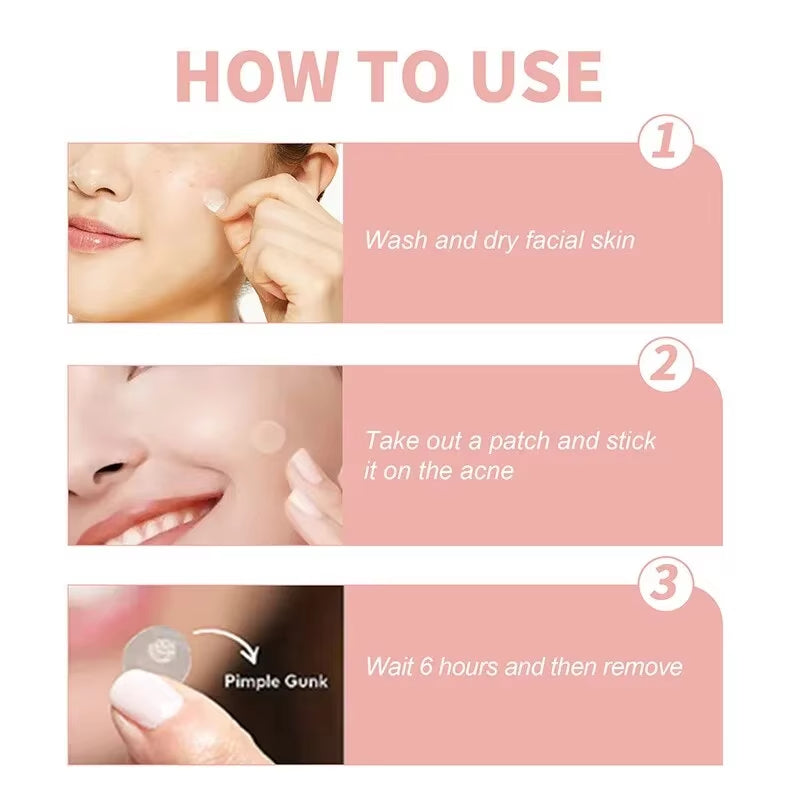 Acne Spot Healing Patches – Invisible Waterproof Stickers for Pimple Removal, Marks, and Scar Care - CartRare