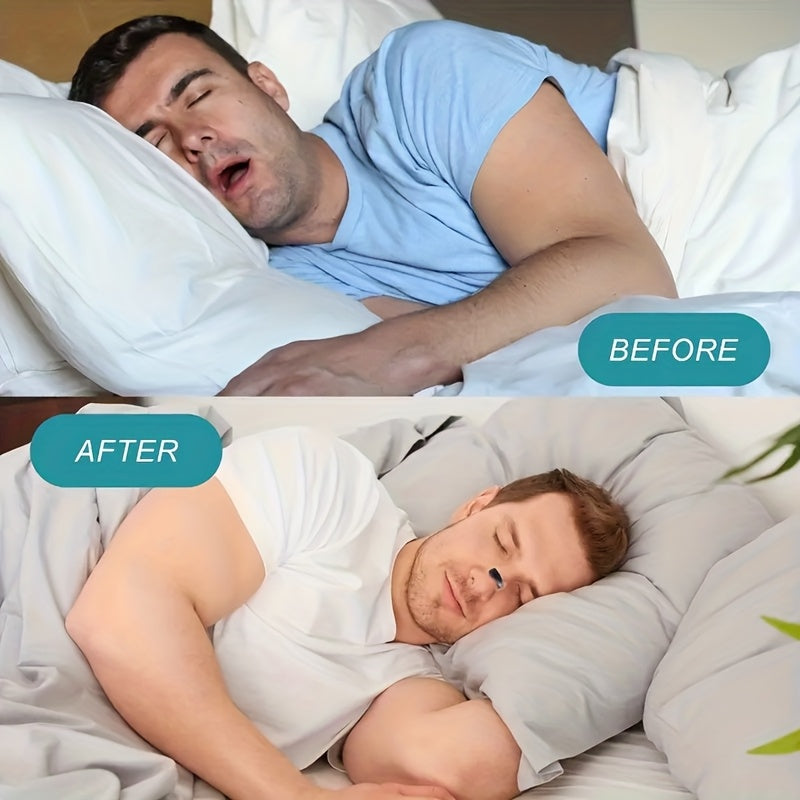 Unisex Nasal Dilators for Snore Relief & Easy Breathing Anti-Slip Design - CartRare