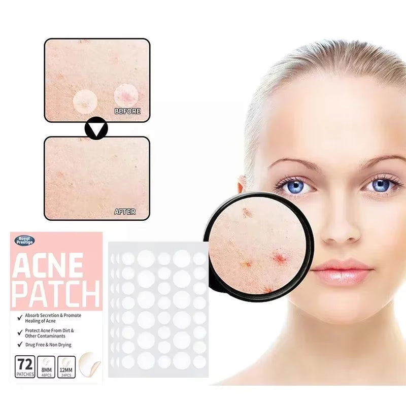 Acne Spot Healing Patches – Invisible Waterproof Stickers for Pimple Removal, Marks, and Scar Care - CartRare