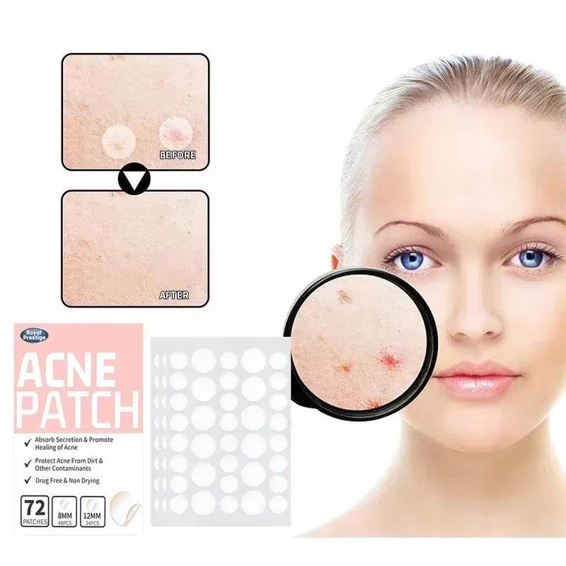 Acne Spot Healing Patches – Invisible Waterproof Stickers for Pimple Removal, Marks, and Scar Care - CartRare