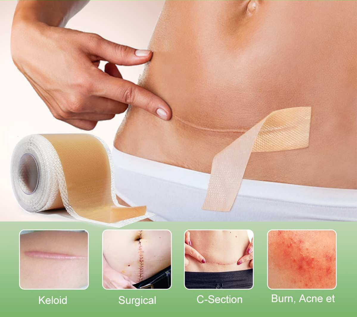 Silicone Scar Tape Reusable - CartRare