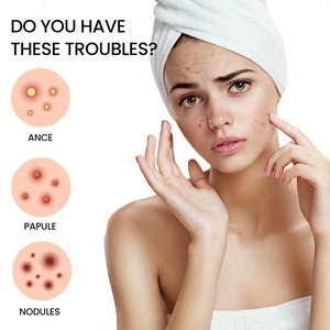 Pimple Patch Acne Dots Heart, Star, Flower & Round Shapes - CartRare