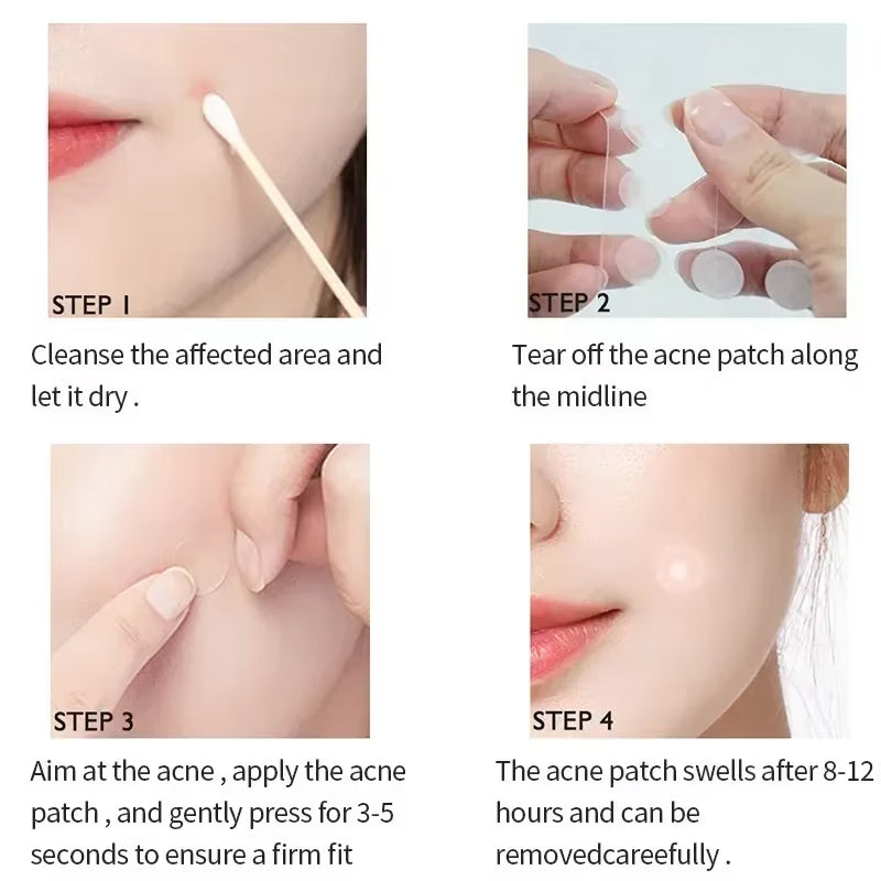 Acne Spot Healing Patches – Invisible Waterproof Stickers for Pimple Removal, Marks, and Scar Care - CartRare
