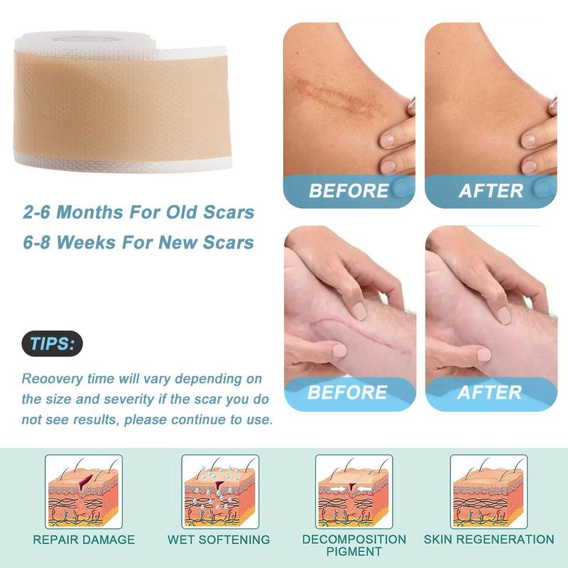 Silicone Scar Tape Reusable - CartRare