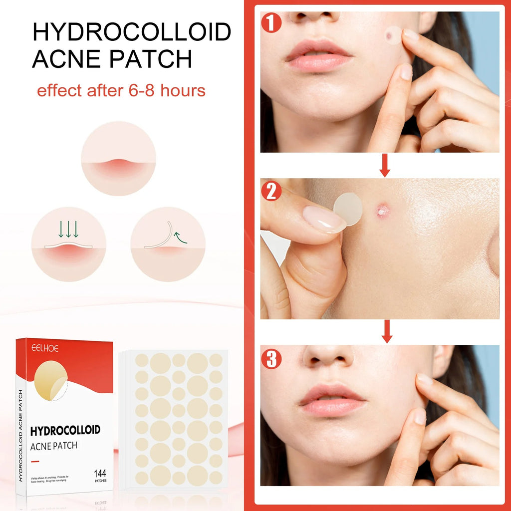 Pimple Patch Acne Dots Heart, Star, Flower & Round Shapes - CartRare